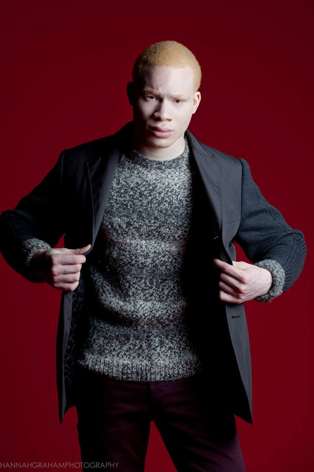 Male model photo shoot of Sir Maejor Albino Model