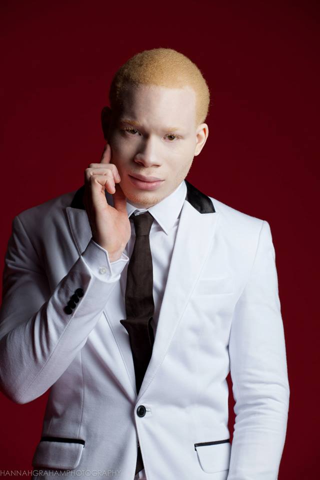 Male model photo shoot of Sir Maejor Albino Model